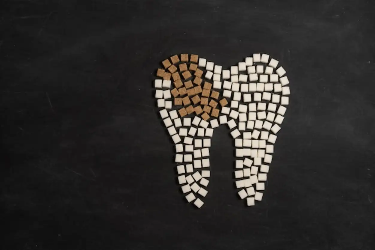 Sugar destroy tooth enamel leads tooth decay  White Sugar cubes shape form tooth brown sugar caries black background Healthcare and medicine Stomatology concept Sweet food destroy teeth